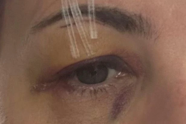 Angry mum left with bloody wound at adventure park during day out with kids