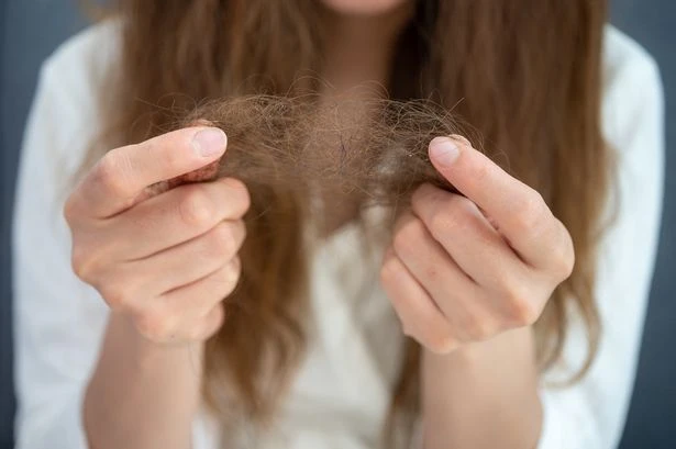 Acne, balding and loss of libido red flags of condition 16% of women have