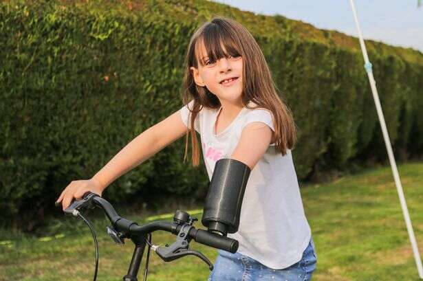 Girl born without arm hopes to fulfil dream of learning to skip as she test-drives £20k bionic limb