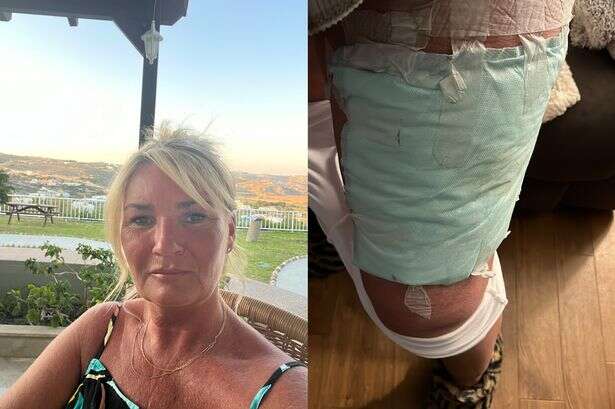 Mum left with third-degree burns after making simple hot water bottle mistake