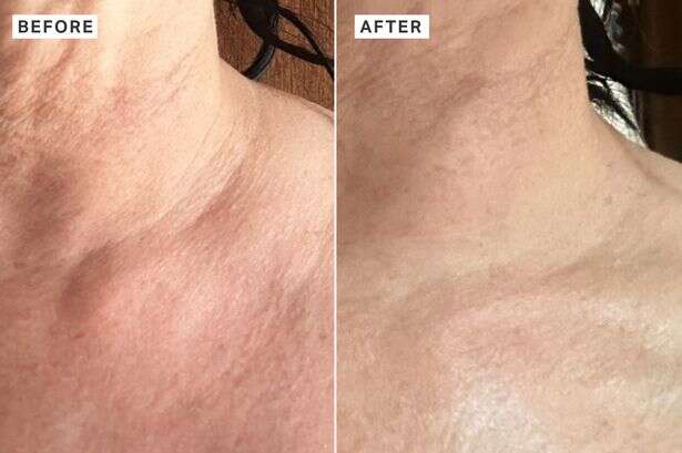 M&S shoppers floored by rapid change in skin after applying 'crepey neck' cream