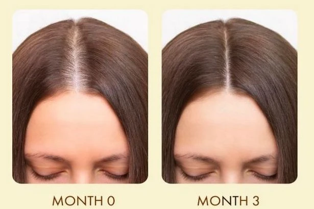 Amazon reduces £18 'amazing' growth serum that 'makes hair feel thicker and stronger'