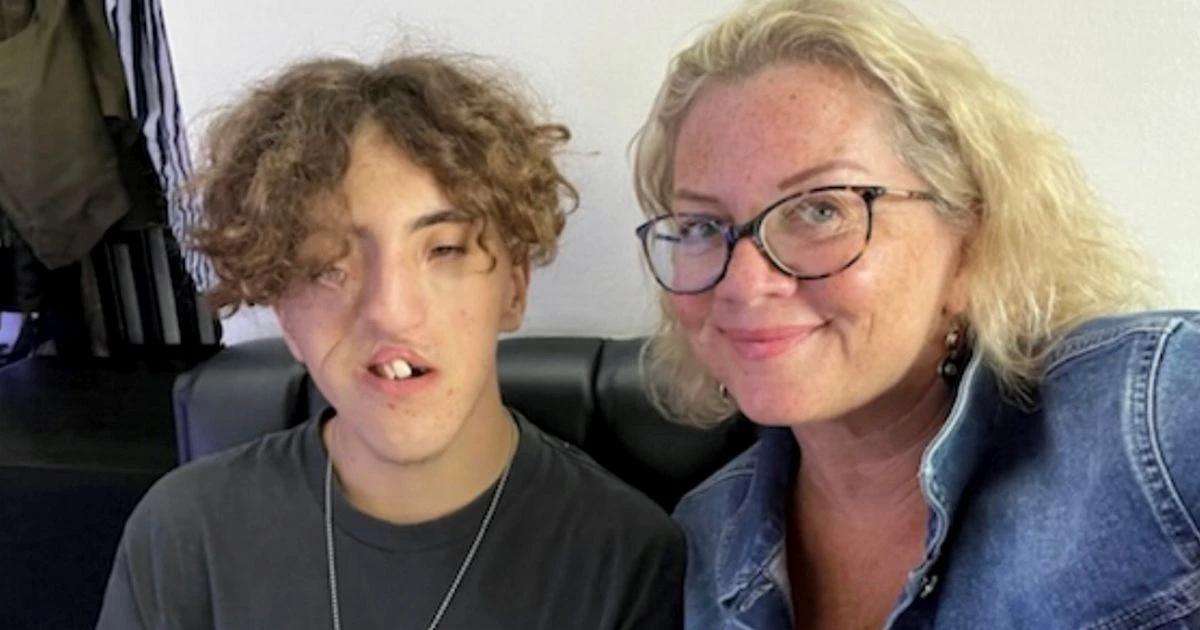 Mum told she was 'cruel' for having her son after he was born with severe cleft lip