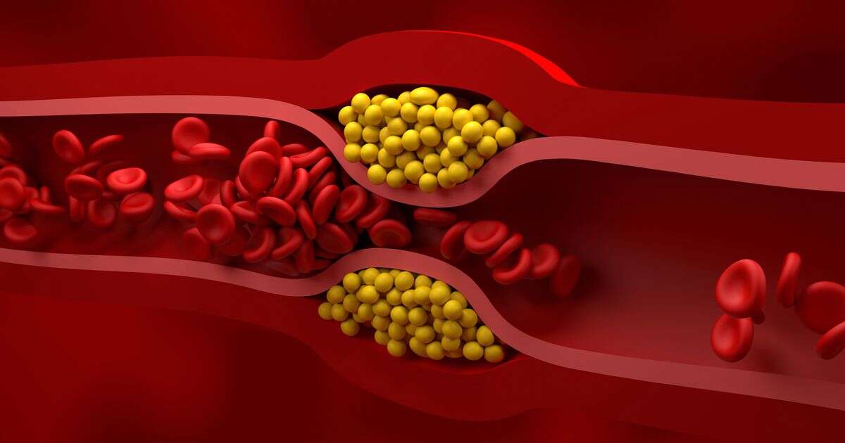 'I'm a professor - here's a common cholesterol-lowering mistake that can make matters worse'