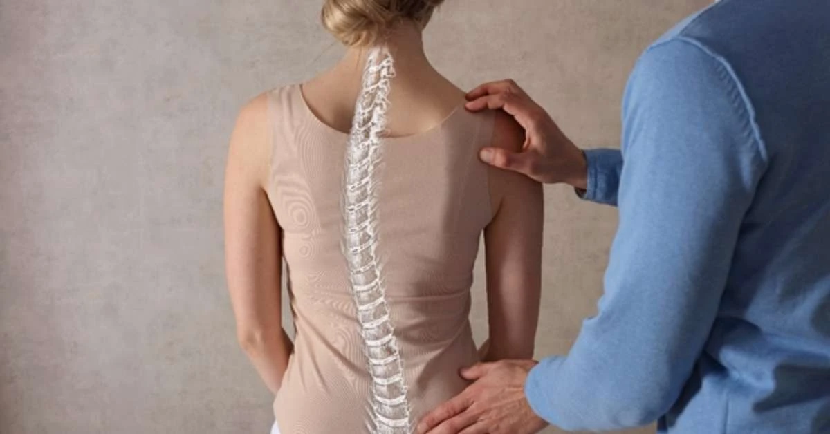 Escoliose: diagnóstico precoce evita cirurgia em 70% dos casos