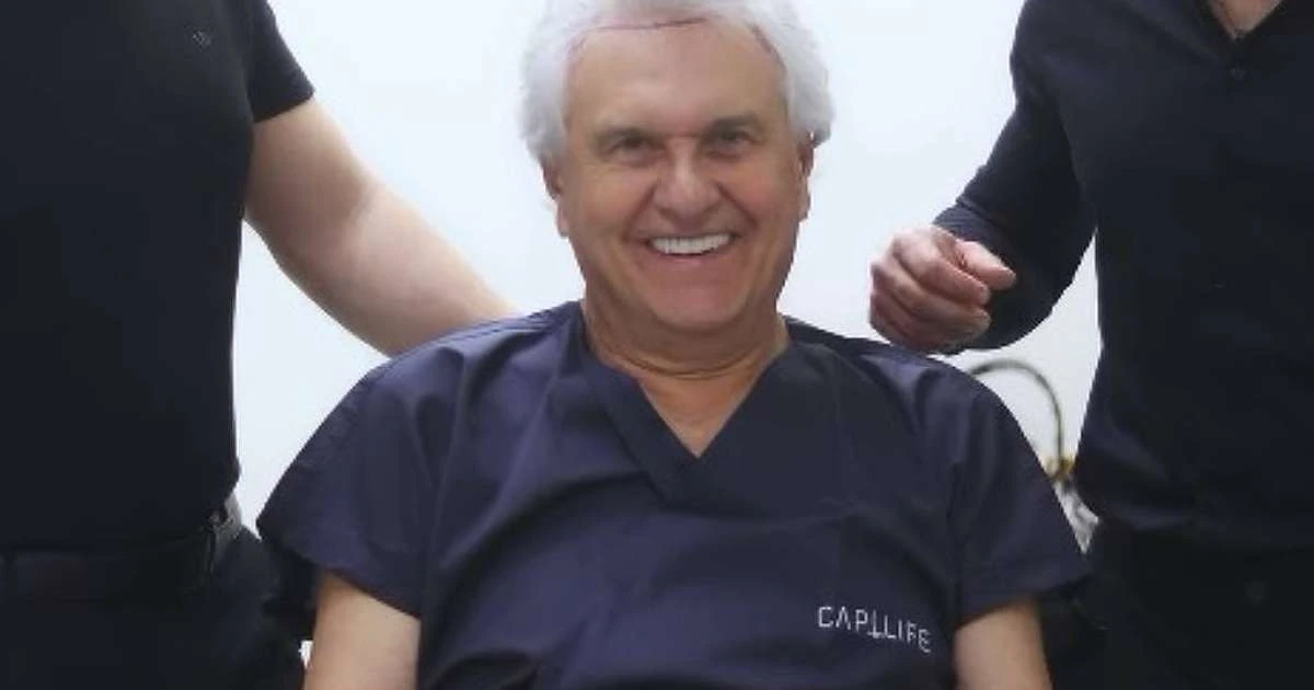 Pré-candidato à presidência e governador do Goiás, Ronaldo Caiado faz transplante capilar