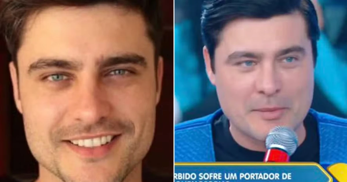 Web detona aparência de Guilherme Leicam: 'Desarmonização'