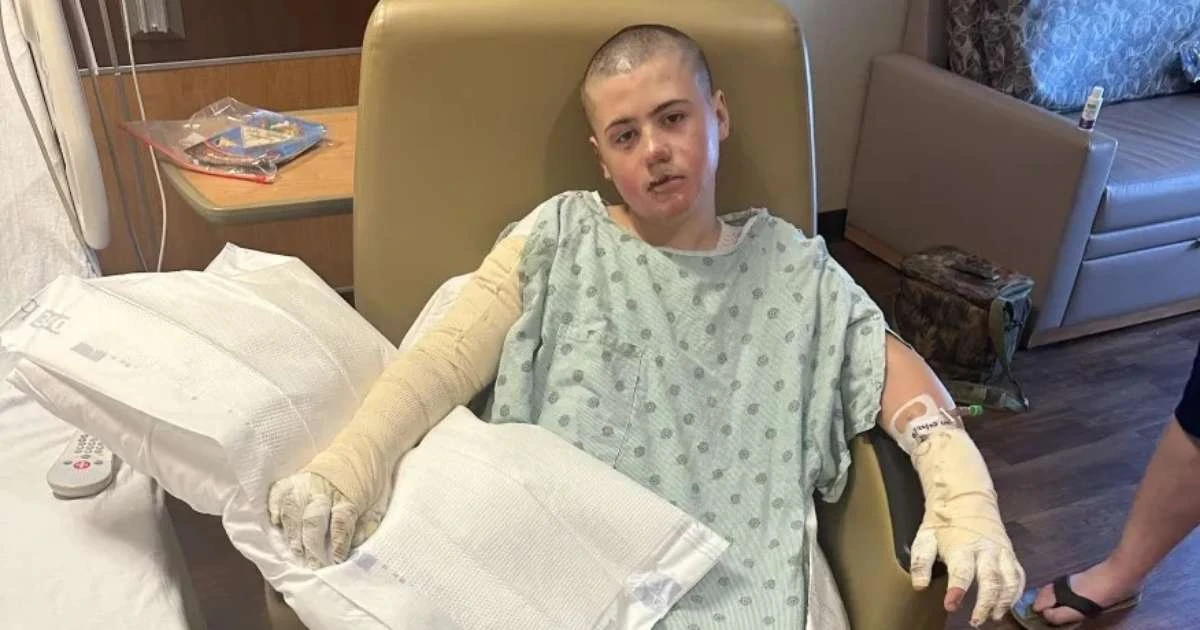 Menino de 12 anos fica internado após se queimar fazendo trend das redes sociais
