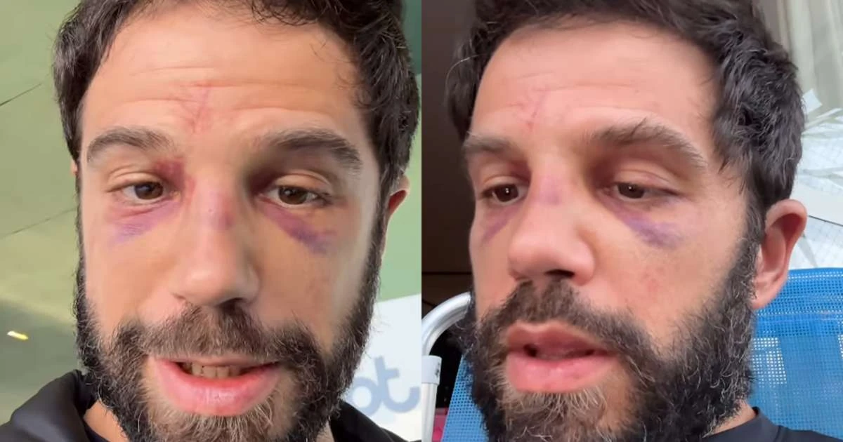 Duda Nagle é impedido de entrar em academia após apanhar de Popó em luta: 'Não reconhece'