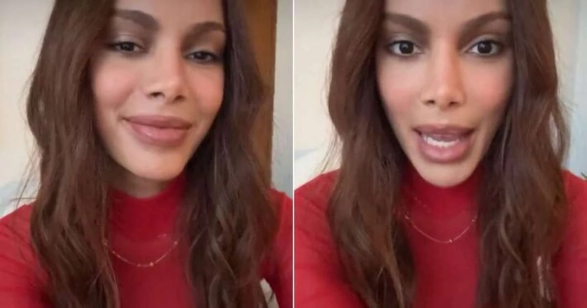 Anitta desabafa sobre repercussão de seu 'novo rosto': 