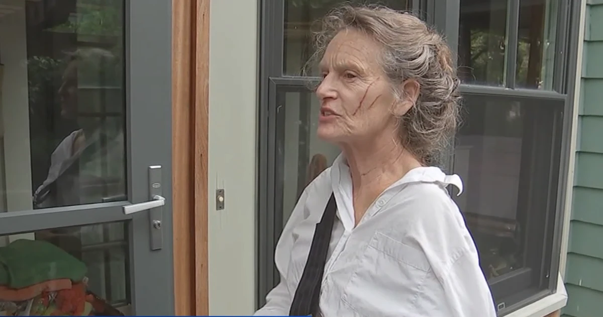 Mulher de 69 anos é atacada por guaxinim enquanto levava cães para passear