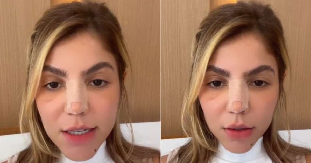 Após rinoplastia, Hariany Almeida desabafa sobre comentários maldosos: 'Ponto fraco'