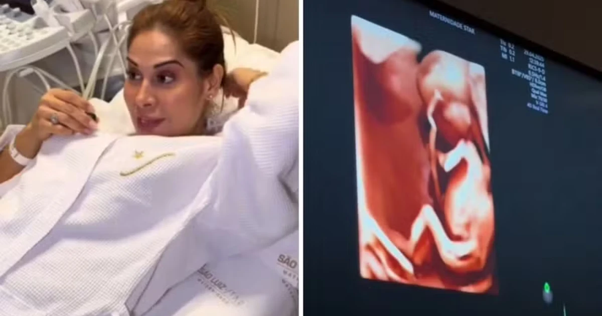 Com medo, Maíra Cardi faz ultrassom morfológico: 'Meu coração tá angustiado'