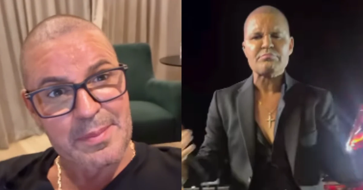 Eduardo Costa revela motivo inusitado da queda de seu cabelo: 'Usei muita'