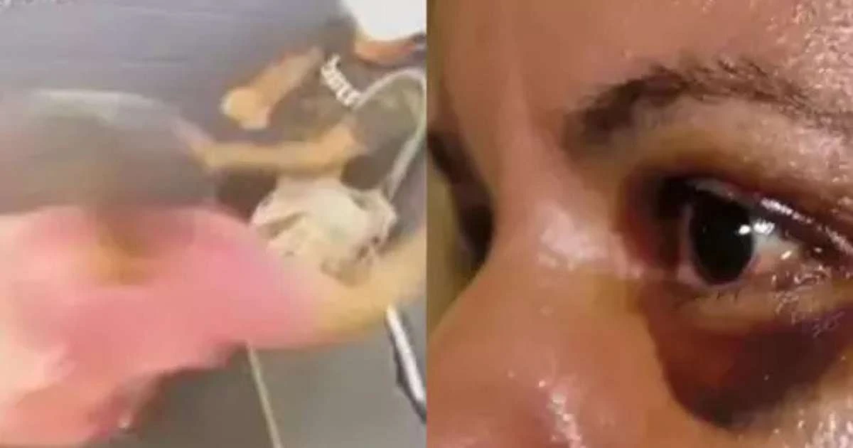 Vítima dos 61 socos relembra falas do agressor durante violência: 'Você vai morrer'