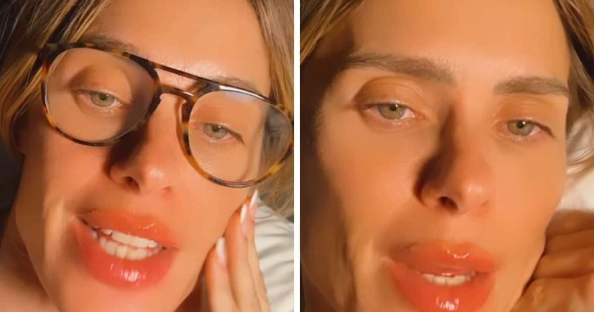 Carolina Dieckmann nega ter feito 'procedimentos louquíssimos' ao surgir com a boca inchada