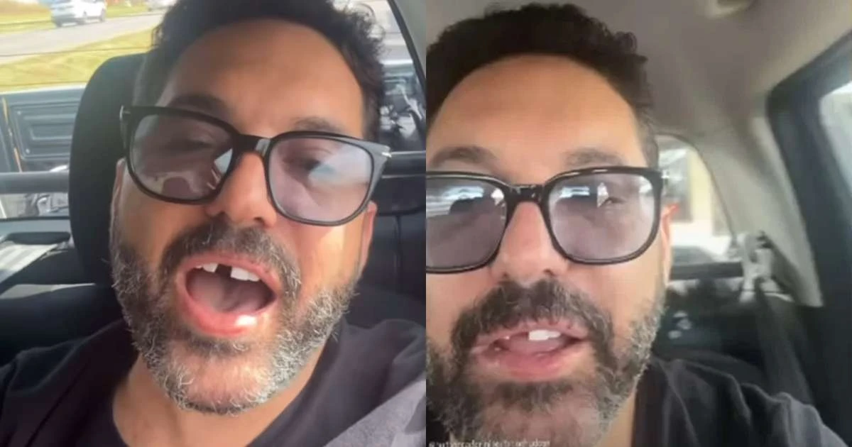 Dupla com Hudson, sertanejo Edson faz apelo após perder dente antes de show: 'Me ajuda'