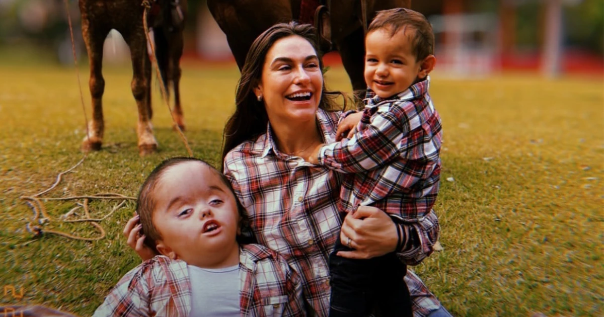 Nora de Ratinho, Bruna Massa conta como chegada de irmão ajudou o filho com hidrocefalia