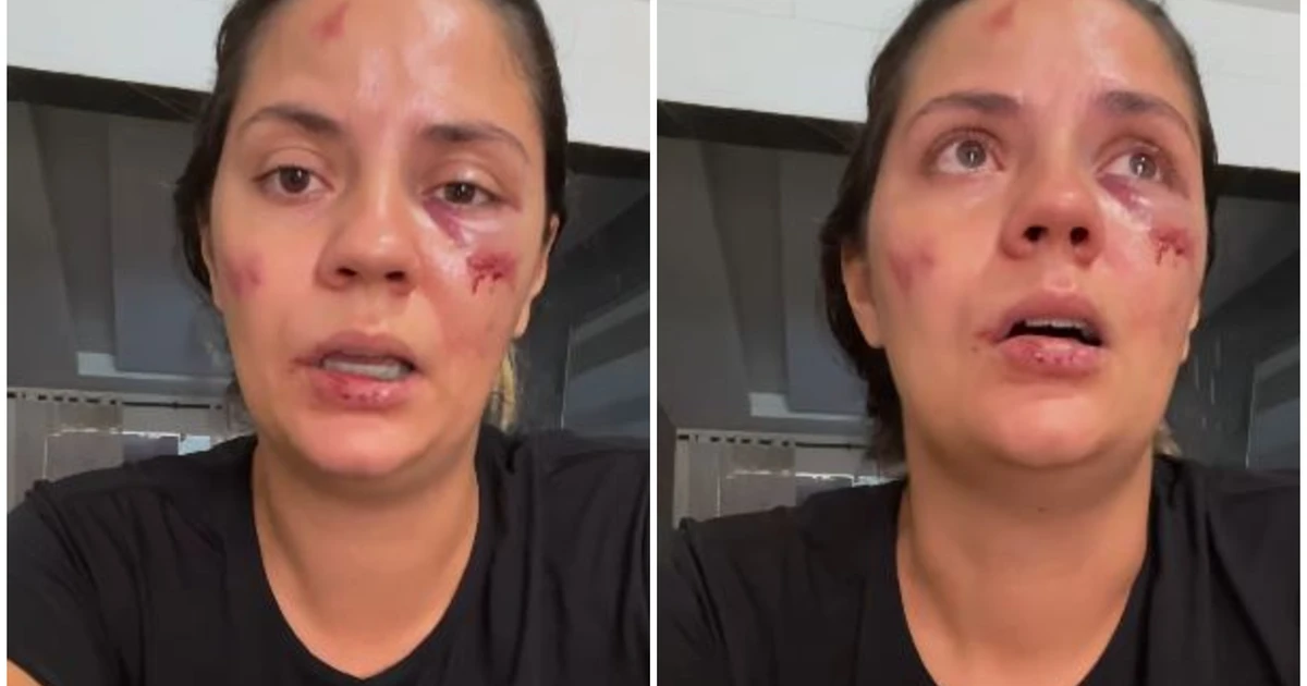 Mulher é arremessada de montanha-russa em parque aquático recém-inaugurado: 'Foi desesperador'