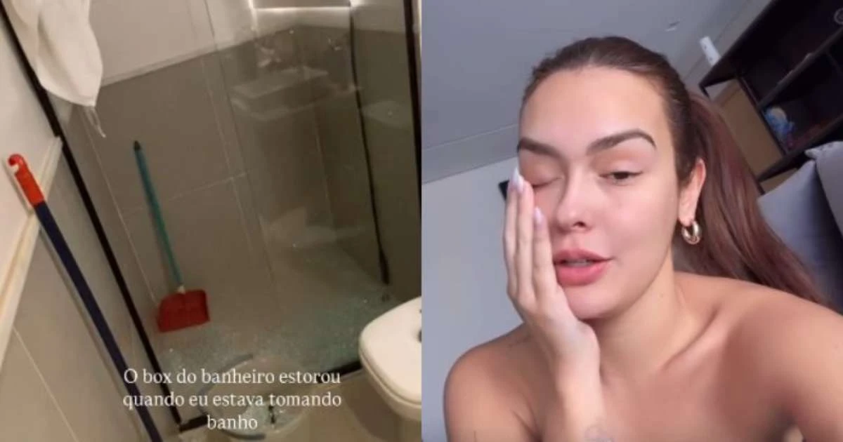 Ex-BBB Larissa leva 14 pontos após acidente delicado: 'Chegou a dar para ver o osso'