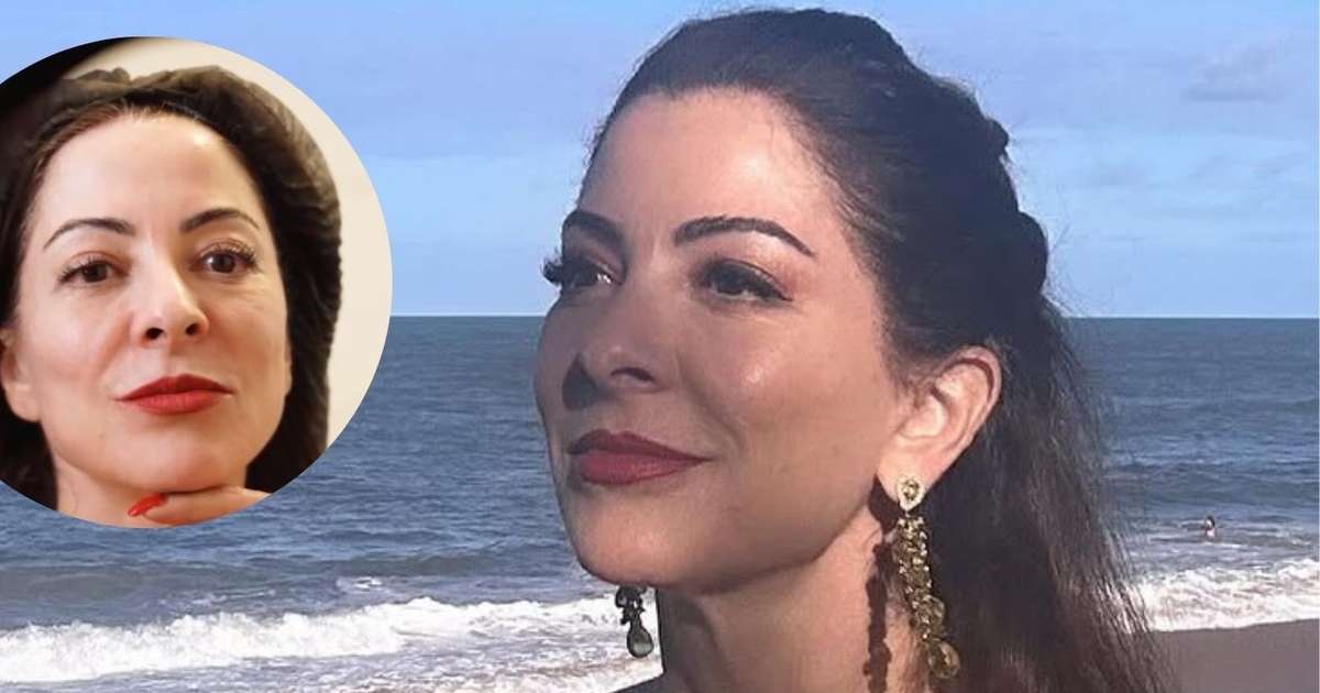 Nada de harmonização! Segredo da beleza de Ana Paula Padrão aos 59 anos é um procedimento estético coreano inovador