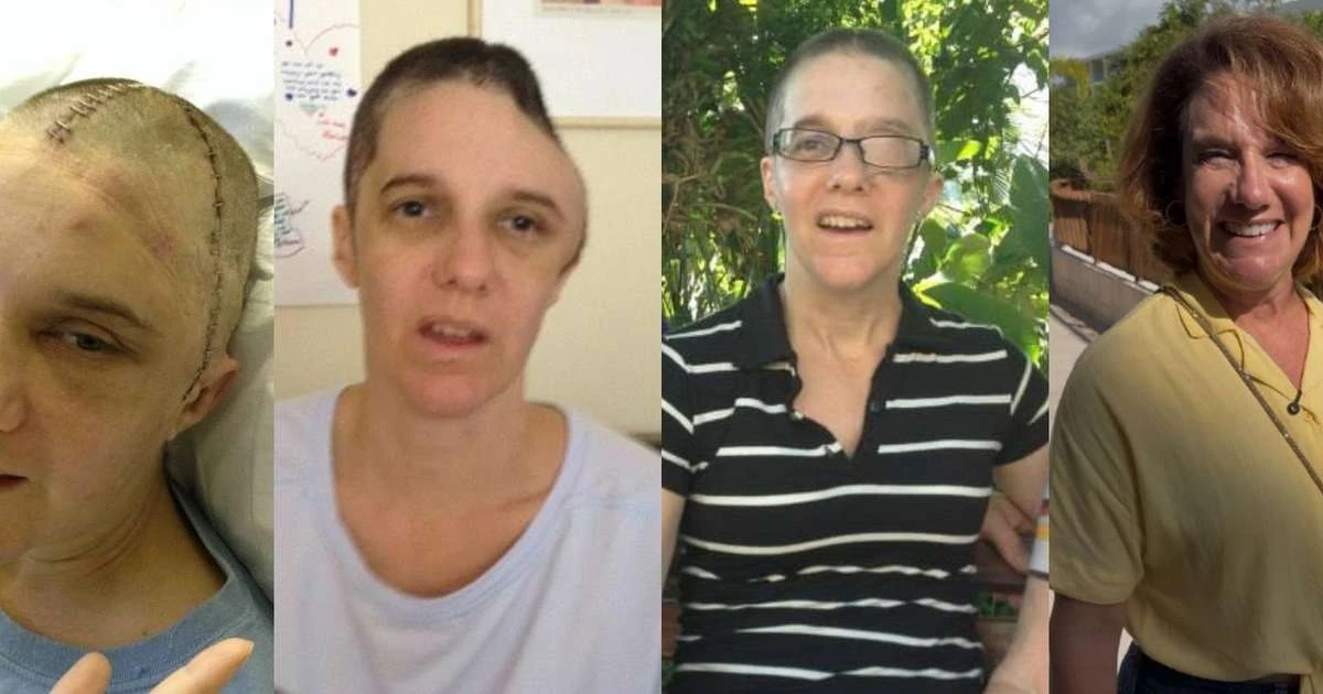 Antes e depois de Renee Murdoch: veja em 32 fotos como está hoje a pastora que ficou entre a vida e a morte após agressão e inspirou o filme 'Fé Para o Impossível'
