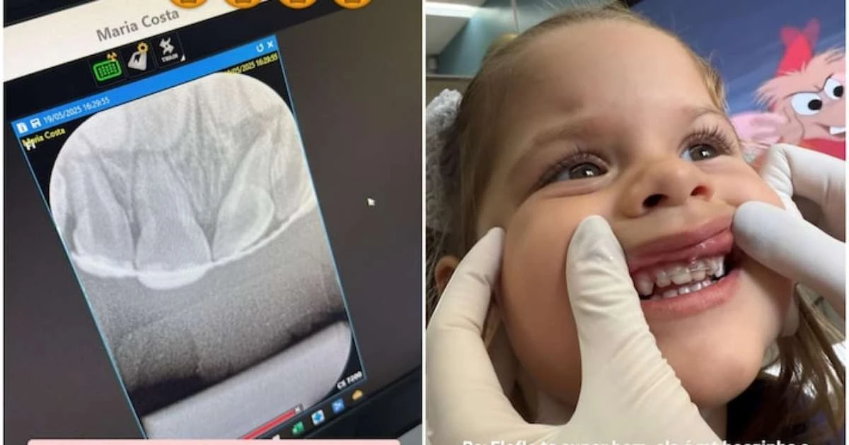 Maria Flor, filha de Virginia, coloca aparelho nos dentes com apenas 2 anos; saiba o motivo
