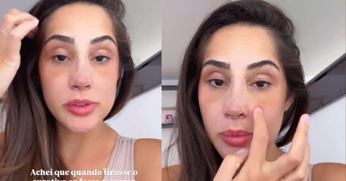 Deniziane atualiza fãs sobre recuperação de rinoplastia: 'Voltar a respirar'