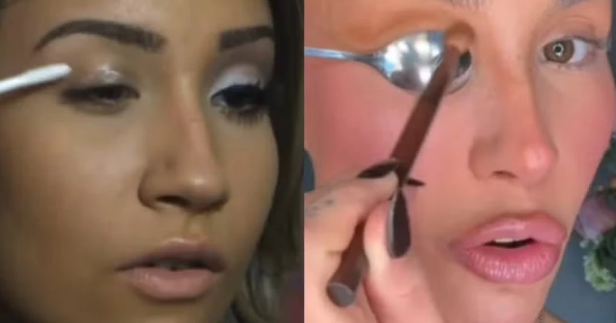 Antes e depois: Bianca Andrade mostra as mudanças no rosto após procedimentos estéticos