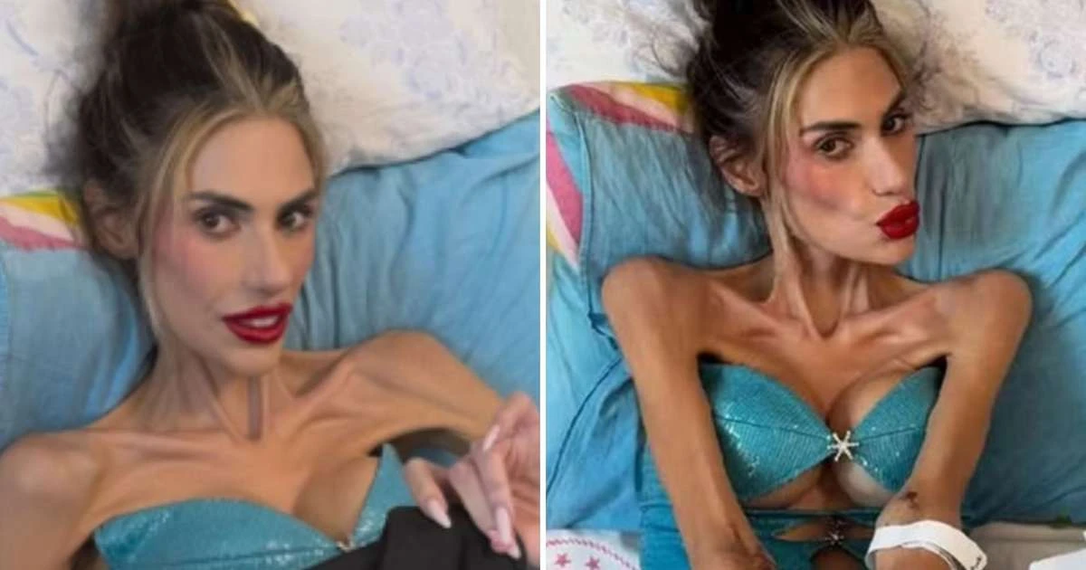 O que acontece com o corpo ao pesar 22 kg? Caso de influencer choca especialistas
