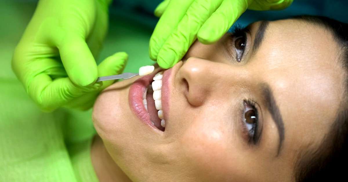 Facetas dentárias possibilitam um sorriso mais alinhado