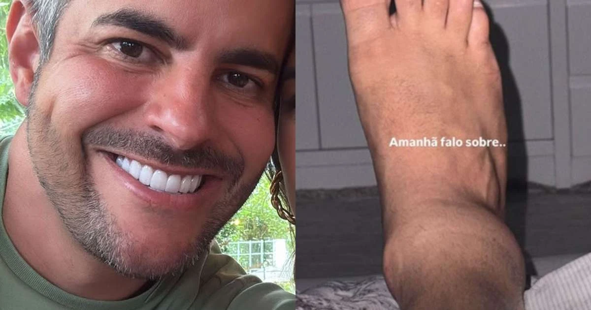 Lesão grave! Marido de Simone Mendes detalha entorse no tornozelo e mostra sofrimento em vídeo