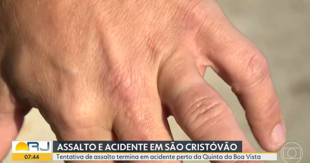 Ladrão usa os dentes para arrancar aliança de vítima durante assalto no Rio