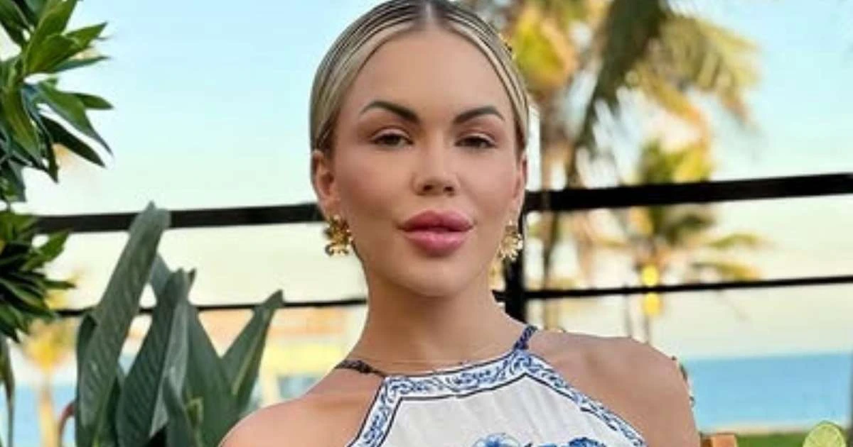 Ex-musa expõe críticas após combo de cirurgias plásticas: 'Magra demais'