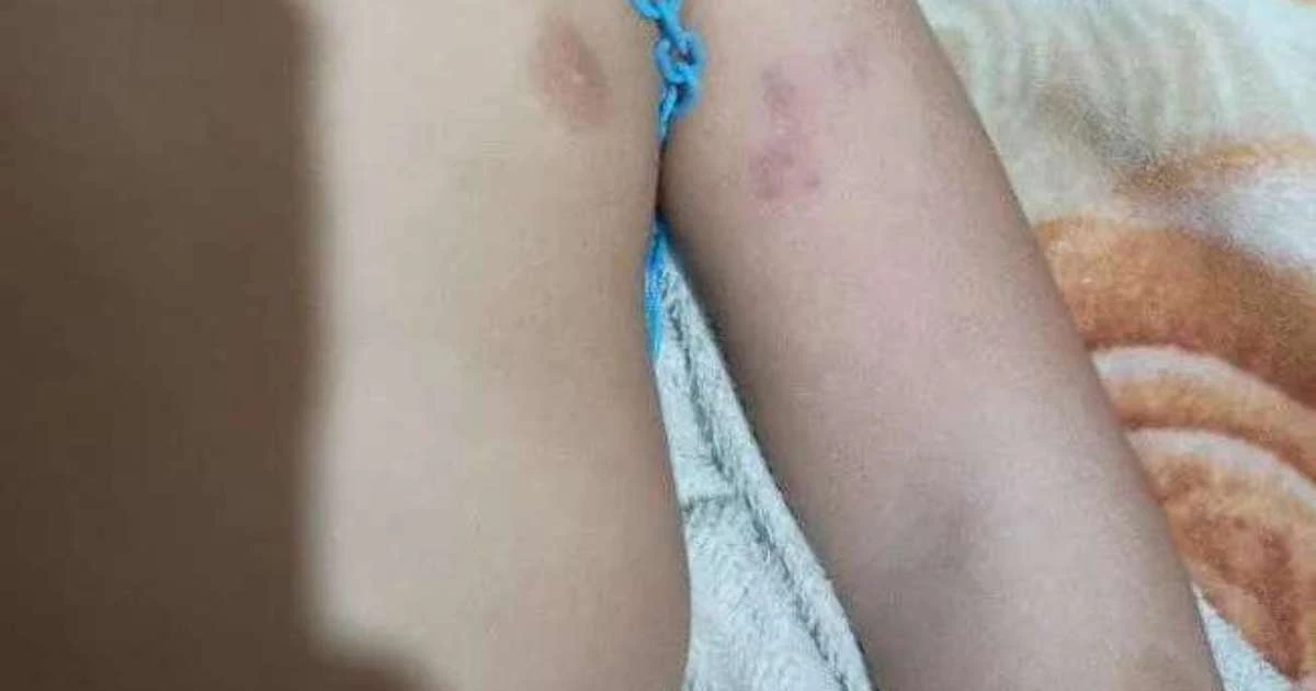 Professora é afastada após denúncia de maus-tratos contra bebê em escola infantil de Três Coroas