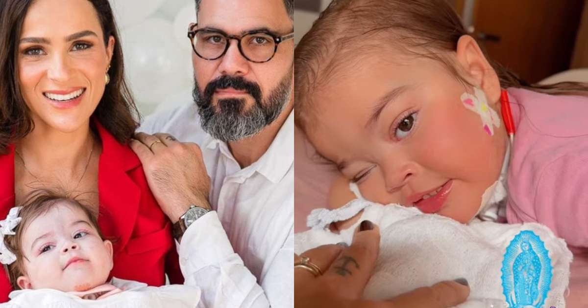 Filha de Juliano Cazarré que tem síndrome rara aparece sem respirador: 'Porcaria'