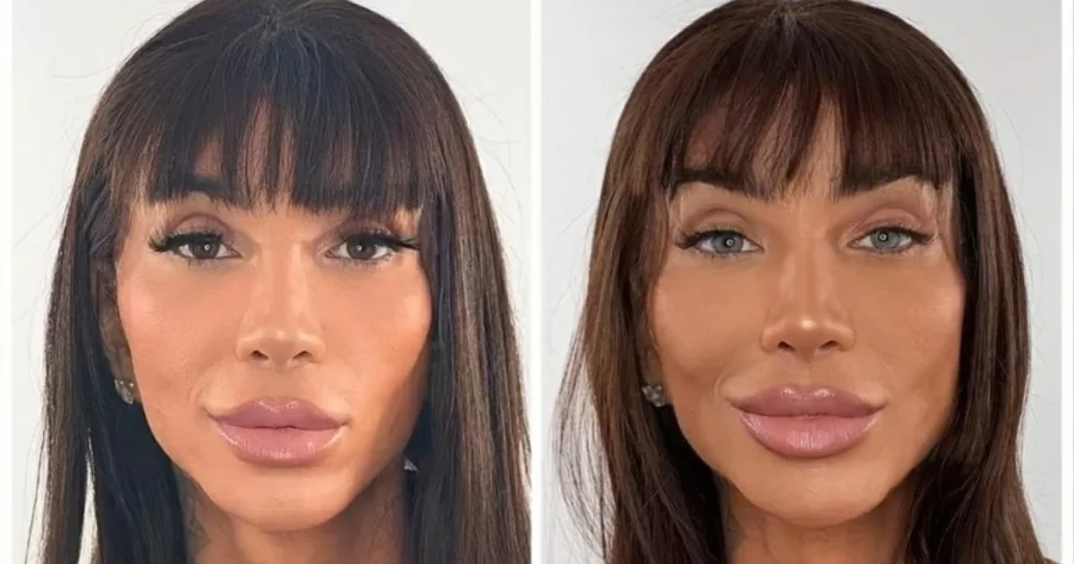 Massafera investe bolada para mudar cor dos olhos; veja fotos