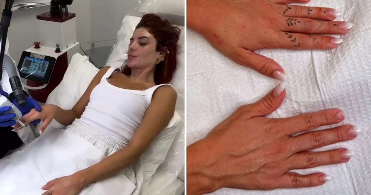 Harmonização de mãos: Conheça o procedimento que está encantando as famosas