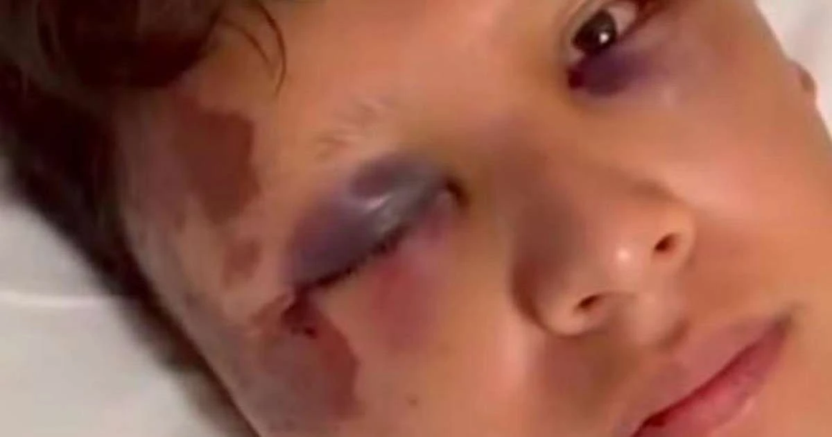 Turista mexicano é agredido com garrafada na cabeça em Copacabana
