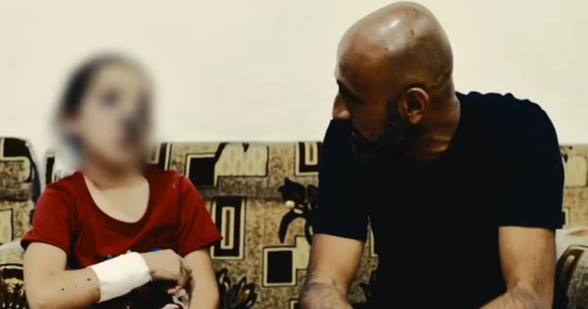 Menina de 8 anos leva tiro no rosto, finge estar morta e é a única sobrevivente de sua família na Síria