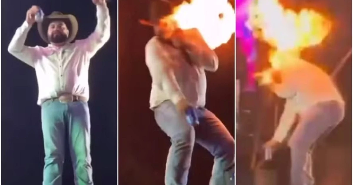 Impressionante! Cantor mostra como ficou o rosto após pegar fogo durante show