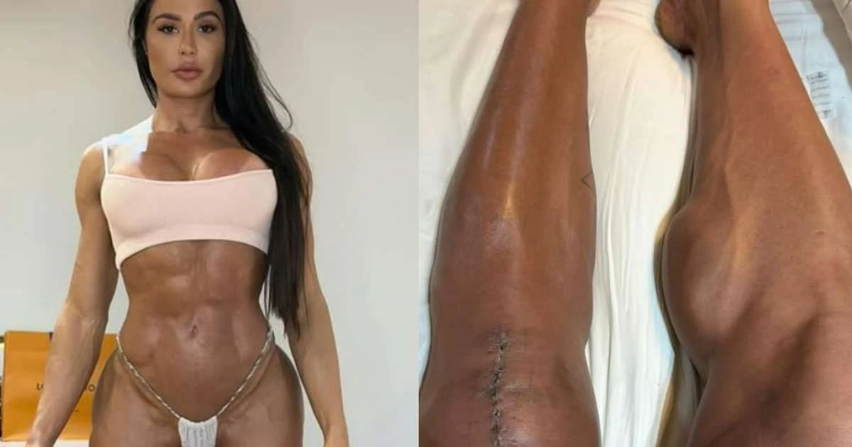 Gracyanne Barbosa mostra o corpo após lesão e cirurgia no Dança dos Famosos