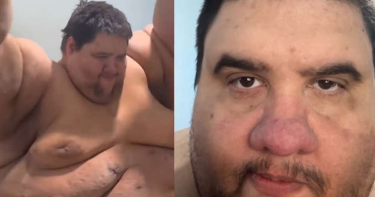 Morre Gabriel Freitas, influenciador que já pesou 380kg e compartilhava seu emagrecimento nas redes