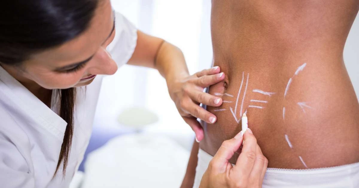 Lipo HD amplia possibilidades da definição corporal
