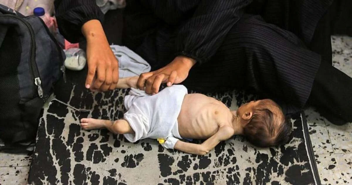 'Pais estão famintos demais para cuidar das crianças': a corrida para liberar ajuda humanitária em Gaza