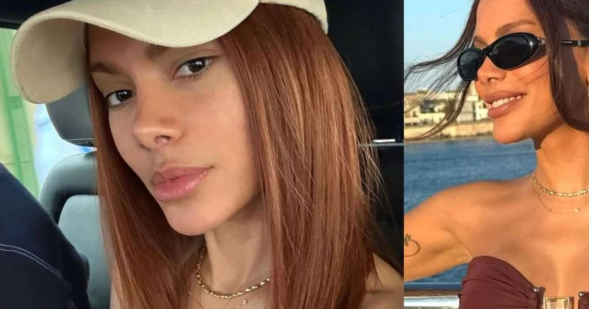 'Irreconhecível': Anitta abre álbum de fotos com selfies e nova aparência após procedimento estético volta a viralizar nos comentários