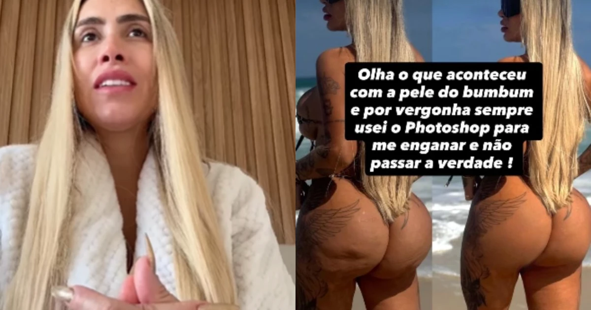 Juju Ferrari é hospitalizada com infecção grave nos glúteos; veja como está
