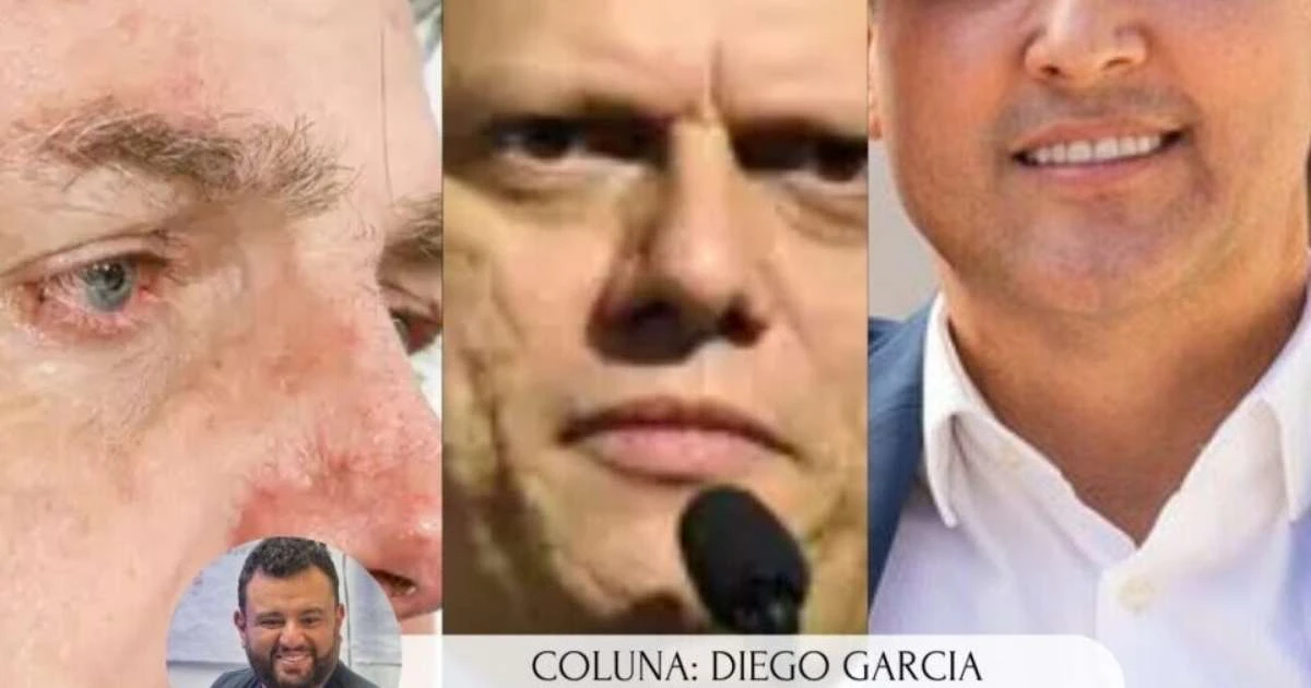 COLUNA | Restrições e eventual prisão de Bolsonaro podem mudar o jogo político no Brasil