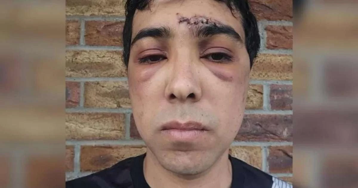 Um ano após ataque xenofóbico na Irlanda, brasileiro ainda espera respostas: 'Tenho exatamente 0 informações'
