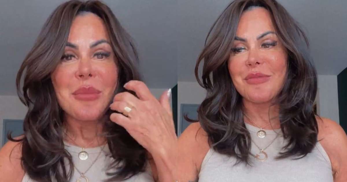 Gretchen expõe motivo de retirada de preenchimento labial: 'Estava pesando'